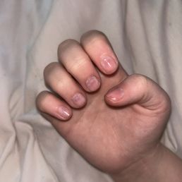 Redness in nails, reaction around cuticles, thin layer of MMA acrylic unable to be removed