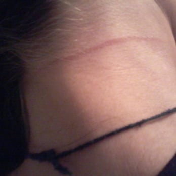 Missouri Lounge - The mark on my neck (not 24 hours after) from one of the Bartenders at this place strangling me to unconsciousness with my scarf. - Dive Bars Near Me - Berkeley, California Missouri Lounge - The mark on my neck (not 24 hours after) from one of the Bartenders at this place strangling me to unconsciousness with my scarf. - Dive Bars Near Me - Berkeley, California