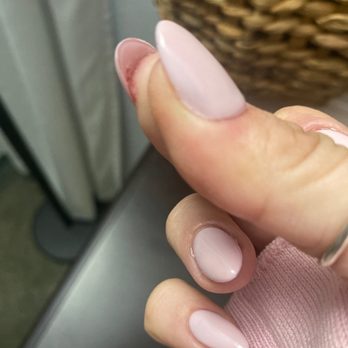 Be Polished Nails-Spa - Cut and subsequent blood from filing - Waxing Near Me - Vista, California