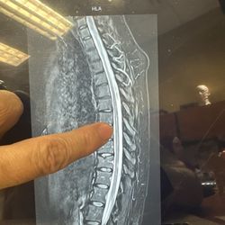 Brain and Spine Center