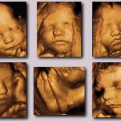 GioImaging