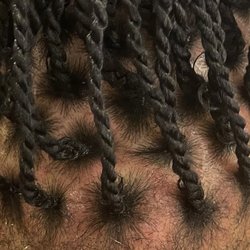 Binta Africa Hair Braiding - Bumps inflammation from the braids being too tight and spite of me telling her they were too tight