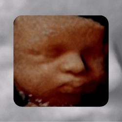 Before We Meet - Sunday Funday with pure perfection ! Visit Before We Meet today and see your peanut in 3D/4D HIGH DEFINITION LIVE REALISTIC imaging!!!