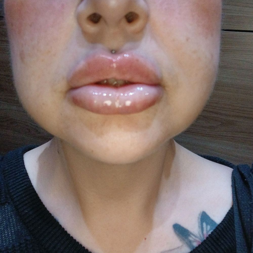NakedMD - This is right after while in the elevator lol - Medical Spas Near Me - Burbank, California NakedMD - This is right after while in the elevator lol - Medical Spas Near Me - Burbank, California