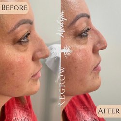 Regrow Med Spa
