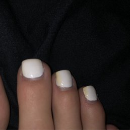 Yellowed white toe nails.