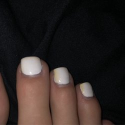 Lee Nail Salon - Yellowed white toe nails.