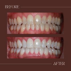 KDA- Kendall Dental Associates