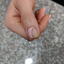 Paint peeling off thumb same afternoon