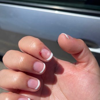 Lovely Nails & Spa - Bleeding finger - Nail Salons Near Me - Yuma, Arizona Lovely Nails & Spa - Bleeding finger - Nail Salons Near Me - Yuma, Arizona