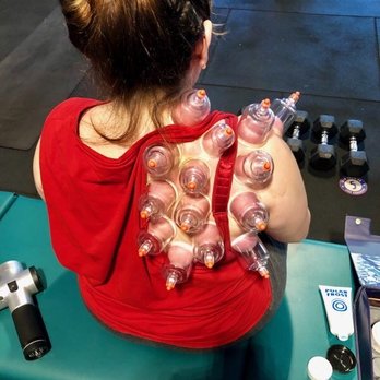 Thrive Elite Wellness Services - One session when Dr. Kat did cupping on my shoulder - literally felt brand new afterwards! - Chiropractors Near Me Thrive Elite Wellness Services - One session when Dr. Kat did cupping on my shoulder - literally felt brand new afterwards! - Chiropractors Near Me