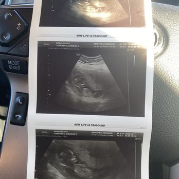 New Life Ultrasound - Got 5 prints in the 2D Tuesday special - Ultrasound Imaging Centers Near Me - Riverside, California New Life Ultrasound - Got 5 prints in the 2D Tuesday special - Ultrasound Imaging Centers Near Me - Riverside, California