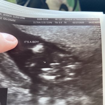 Unique Ultrasound Redlands - from our gender reveal ultrasound - Ultrasound Imaging Centers Near Me - Redlands, California