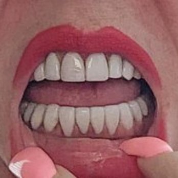 Nicholas Gih, DDS - General Dentistry Near Me - Claremont, California