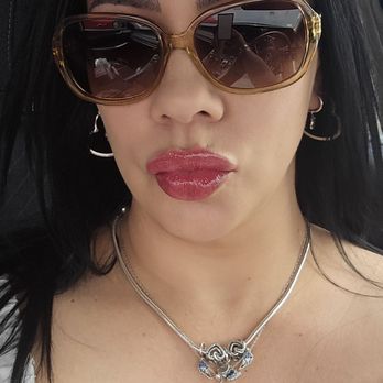 Ideal Image Braintree - Lip filler by David at Ideal Image Braintree MA. Awesome! - Laser Hair Removal Near Me - Braintree, Massachusetts