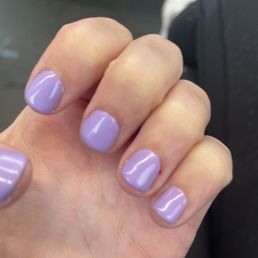 Bleeding cuticle Bleeding cuticle