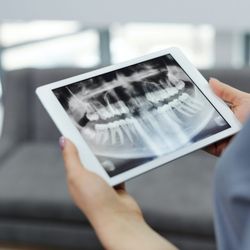 Endodontists of Illinois - Since 2004 we've provided only the best in patient care & endodontic care for the entire Central Illinois area. Now accepting new patients!
