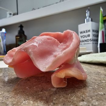 Fioritto Family Dental - Left side closes, while the right side is lopsided. This causes my jaw pain every single day, "Just deal with it." - Cosmetic Dentists Near Me - Mentor, Ohio