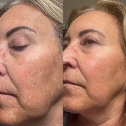 Shanna Fae Skin Care - Amazing results from Korean Skin Care!