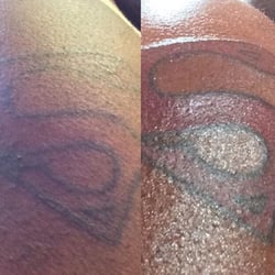 Wonderland Tattoo Studio - Superman logo