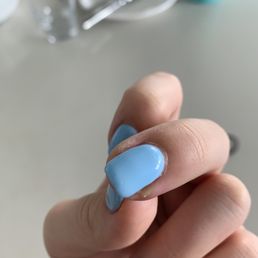 Infected finger