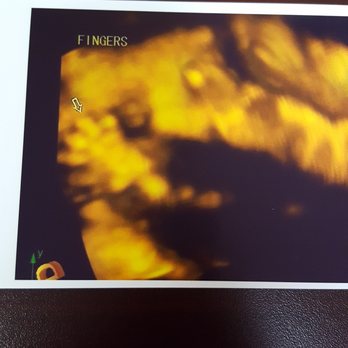 Peek-A-Boo 3D/4D - Diagnostic Imaging Near Me - Orange, California