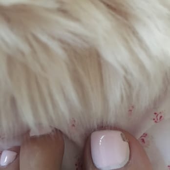 GLO Nail Bar - Worst pedicure ever. I want a refund. This is 3 days old. Not acceptable. - Nail Salons Near Me - Costa Mesa, California GLO Nail Bar - Worst pedicure ever. I want a refund. This is 3 days old. Not acceptable. - Nail Salons Near Me - Costa Mesa, California