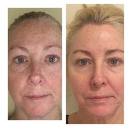 Northeast Dermatology Associates