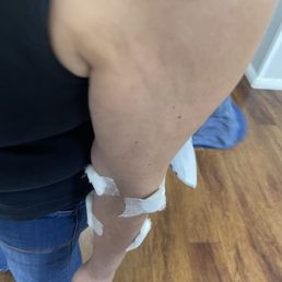 My moms arm