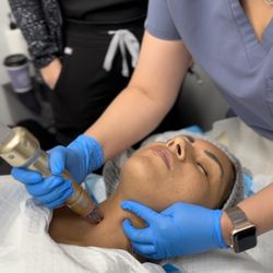 Soma Medical Spa - Skin tightening with Sylfirm X and Exosomes! For texture, skin tightening and collagen production.