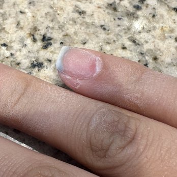Lee's Spa Nail - Burnt pinky nail with the drill. - Nail Salons Near Me - Monroe, North Carolina