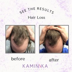 Kaminska Dermatology