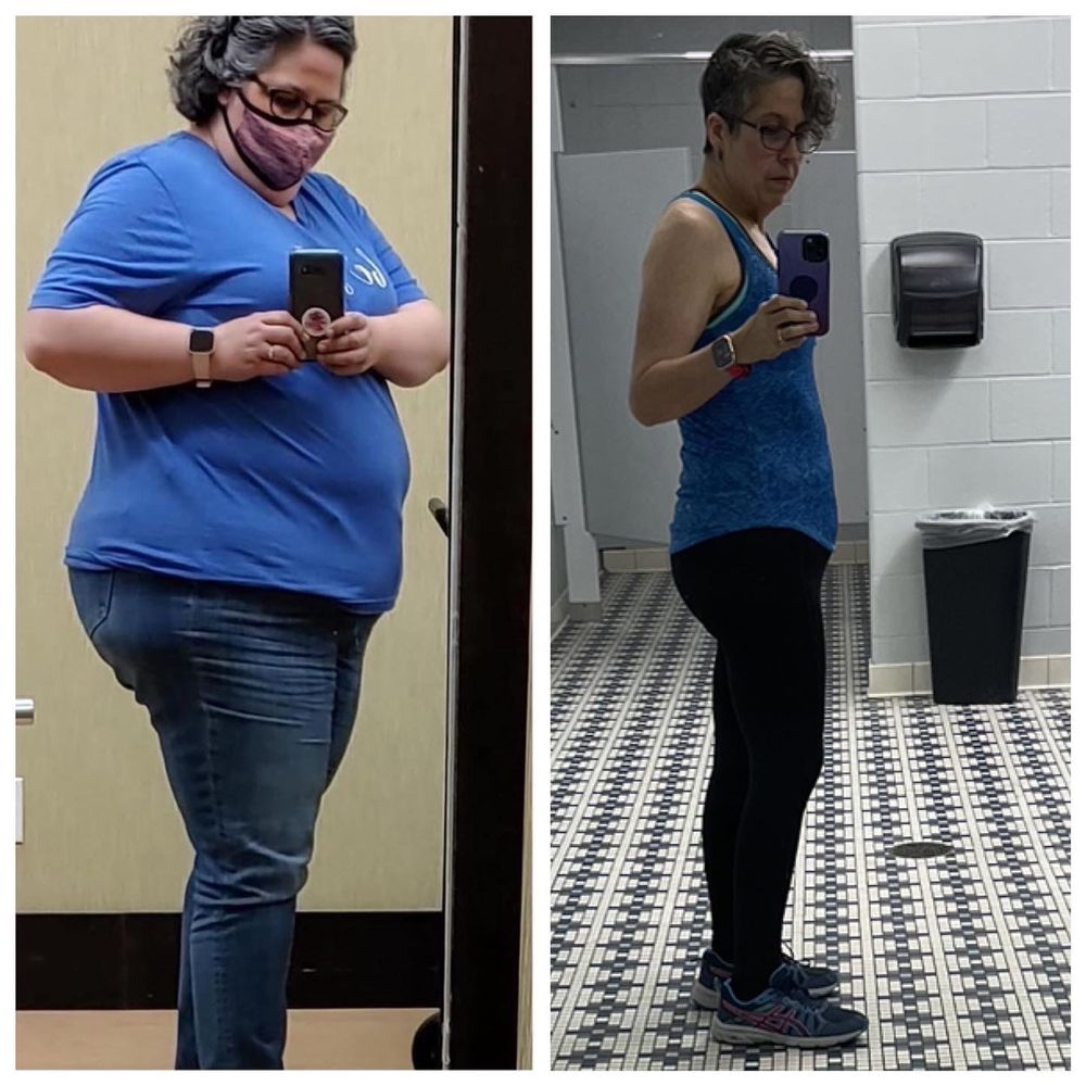 ARCH BARIATRICS Updated October 2024 20 Photos 12152 Tesson Ferry