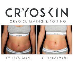 Utopian Skin - Slim in minutes!