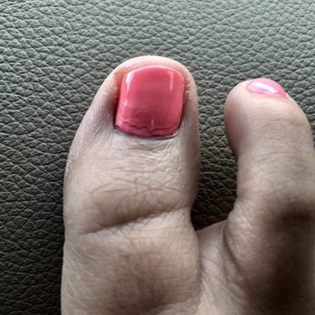 Upscale Nails Bar - Uneven nail shape, bad paint, cuticles not trimmed correctly. Dry skin not exfoliated. - Day Spas Near Me - Arlington, Texas Upscale Nails Bar - Uneven nail shape, bad paint, cuticles not trimmed correctly. Dry skin not exfoliated. - Day Spas Near Me - Arlington, Texas