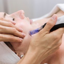 Coastside Healing Arts - NEW! Microneedling, aka Collagen Induction Therapy is now offered in office