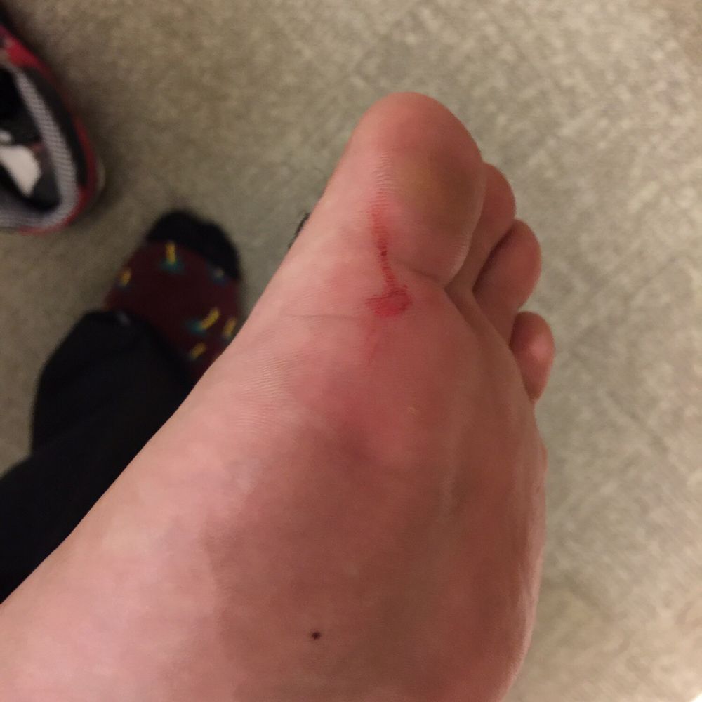 Macy's - Boyfriends foot after he stepped on a needle that was facing up in the suit dressing room - Department Stores Near Me - Brea, California
