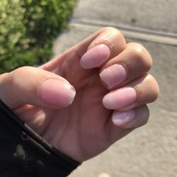 Middle finger and thumb and you can also see cracks on other nails
