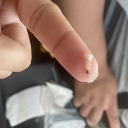 a person's finger with a white substance on it a person's finger with a white substance on it