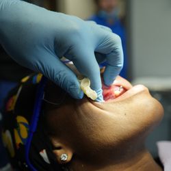 Affordable Dental Health Providers - Downey - Dr. Cohen working on a dental implant patient.