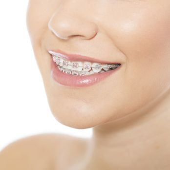 Just For Grins Orthodontics - Achieve the beautiful smile you've always wanted. Contact Dunn & Schreiber Orthodontics today! - Orthodontists Near Me - Millbrook, Alabama Just For Grins Orthodontics - Achieve the beautiful smile you've always wanted. Contact Dunn & Schreiber Orthodontics today! - Orthodontists Near Me - Millbrook, Alabama