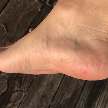 Lavender Nail Bar - Nail tech cut my heel - Nail Salons Near Me - Plano, Texas Lavender Nail Bar - Nail tech cut my heel - Nail Salons Near Me - Plano, Texas