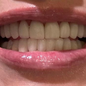 SmileStyle Dental Studio - Dr. Ahmadi's great work! - General Dentistry Near Me - San Diego, California SmileStyle Dental Studio - Dr. Ahmadi's great work! - General Dentistry Near Me - San Diego, California