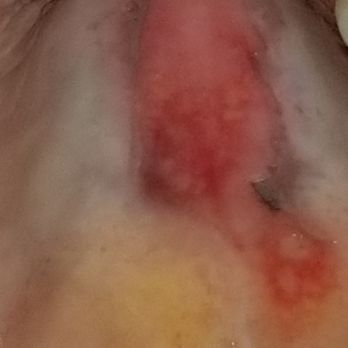 Lovina - Check out this awesome mouth burn I got off the tomato  soup last weekend  - sent a polite email to owner / no response. - New American Near Me - Calistoga, California
