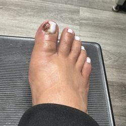 A Nails - A nails no es un lugar limpio y recomendable, katty me lastimó un nervio y fui de emergencias y me cortaron la mitad de mi uña