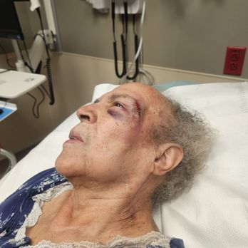 His Grace Senior Living Center - Injuries she received at His Grace - Assisted Living Facilities Near Me - Katy, Texas His Grace Senior Living Center - Injuries she received at His Grace - Assisted Living Facilities Near Me - Katy, Texas