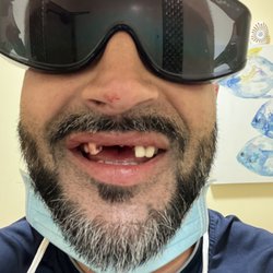 Sethi Virdi DDS - Removed old bridge and dead tooth