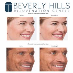 Beverly Hills Rejuvenation Center - Westlake Village - Wrinkle and anti-aging treatments with some of the most celebrated brands like Botox, Juvederm, Dysport and more.