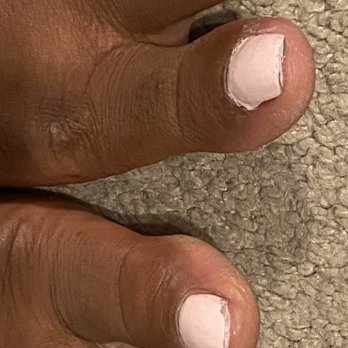 Jane Dynasty Nails - An even more drastic view of a horrible paint job and acetone on my cuticles - Nail Salons Near Me - Hawthorne, California