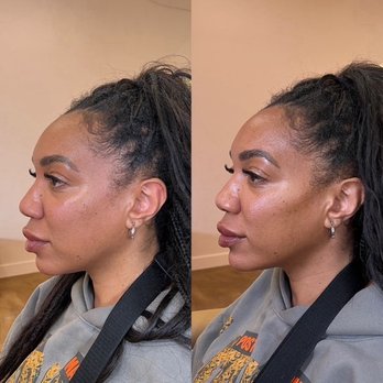 Lara Clinic - Chin, cheeks, lips - Medical Spas Near Me - Oklahoma City, Oklahoma Lara Clinic - Chin, cheeks, lips - Medical Spas Near Me - Oklahoma City, Oklahoma